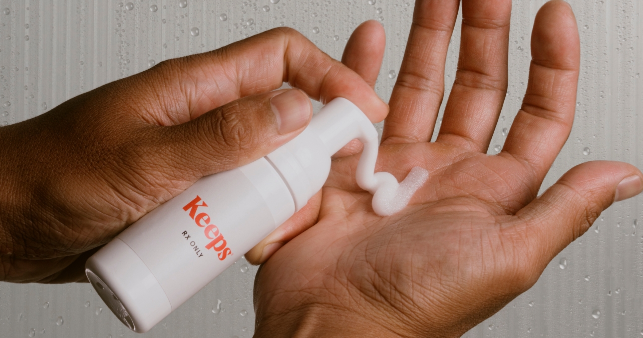 Hands holding a can of topical finasteride and minoxidil foam in one hand, and foam in the other