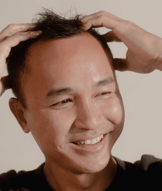 Minoxidil Foam Product