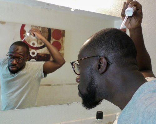 how do you use minoxidil