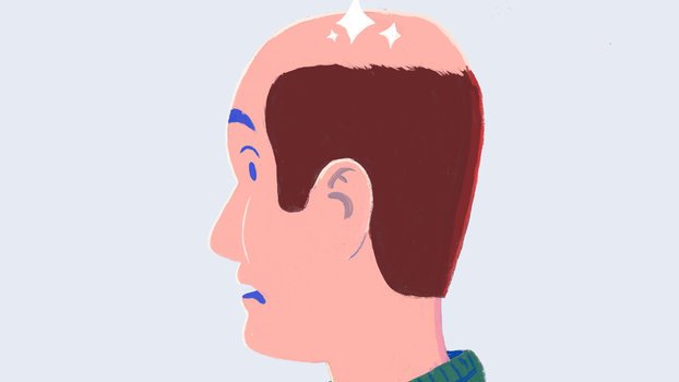 mens hair loss keeps