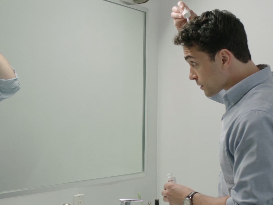 Minoxidil hair styling