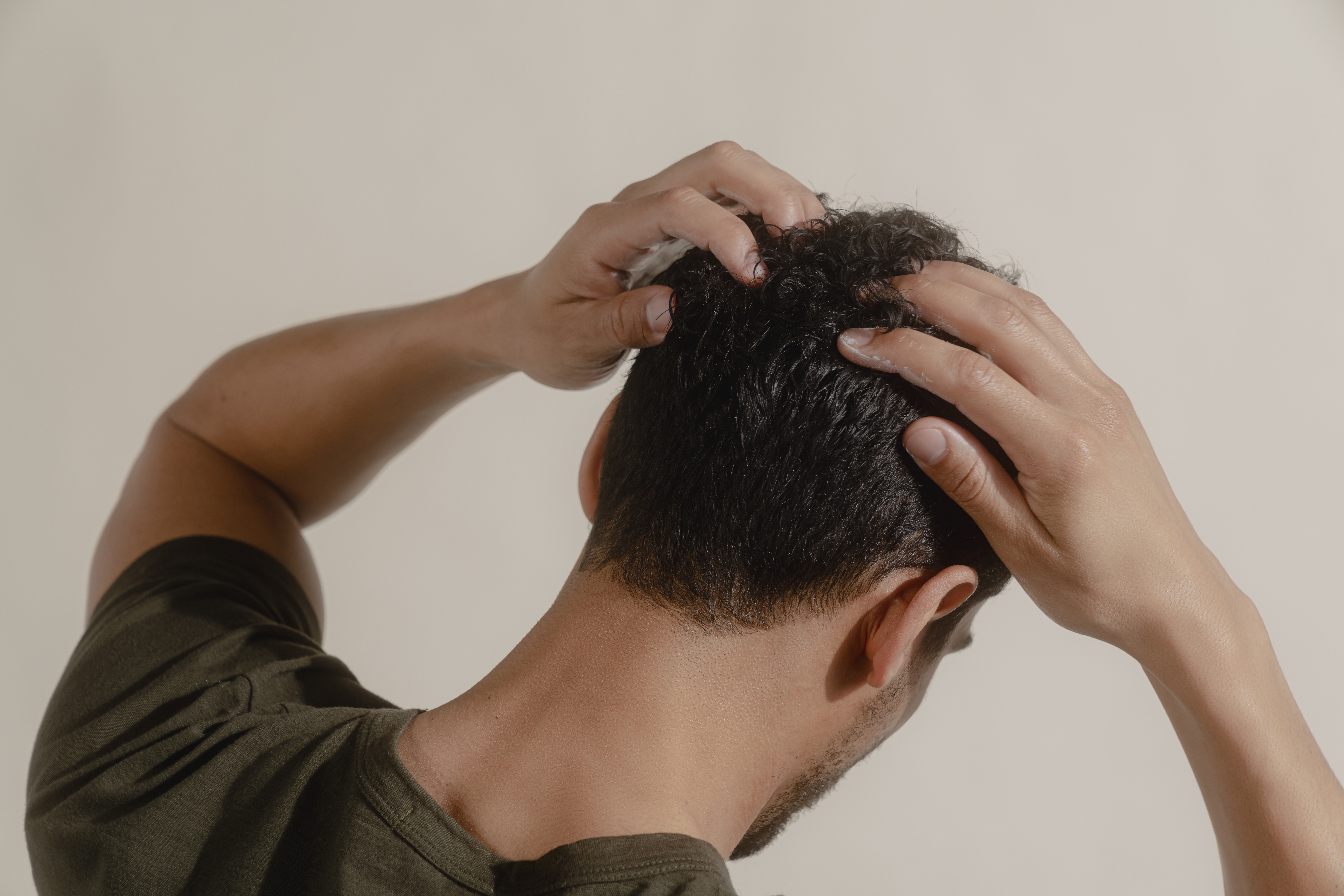 signs of hair losss