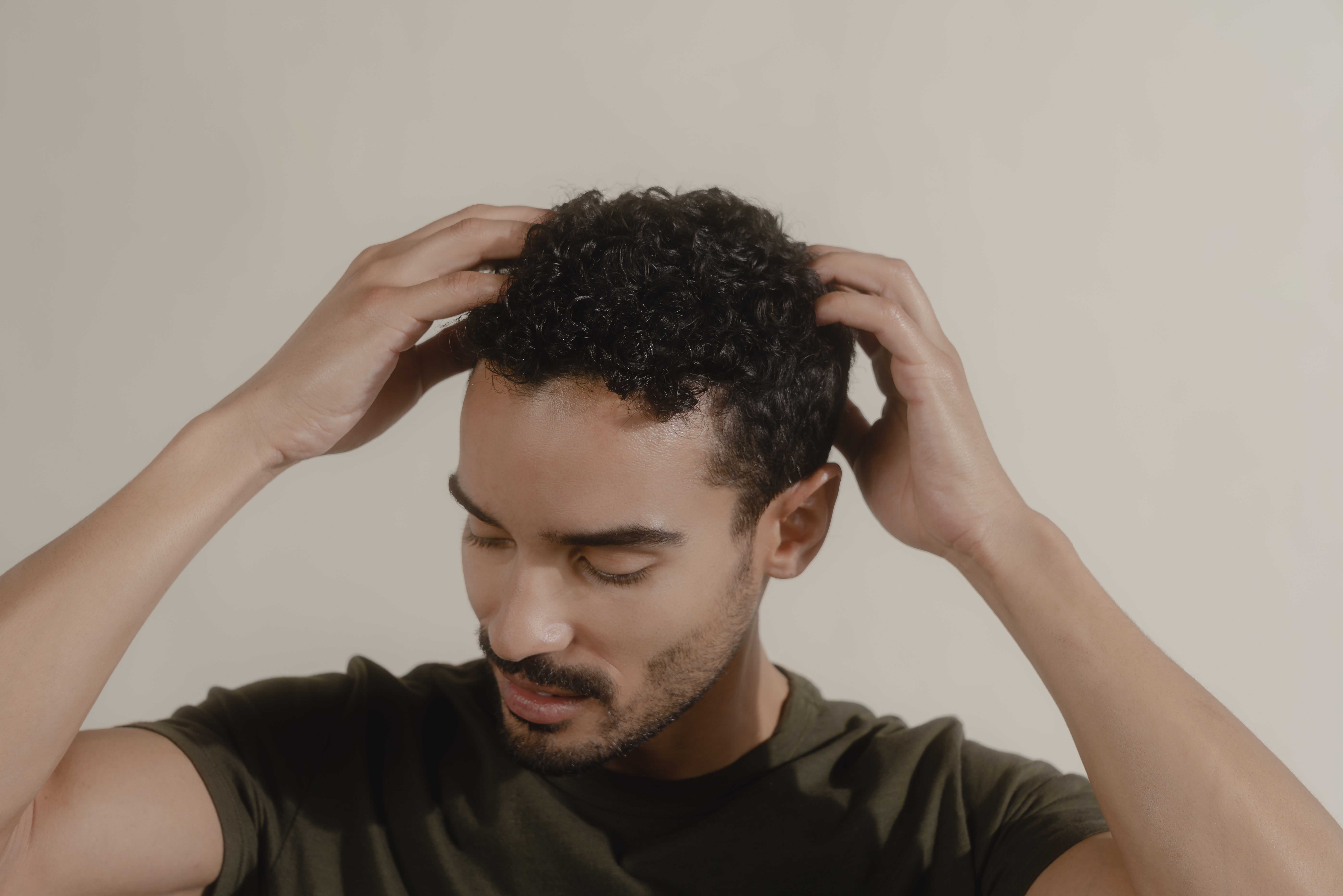 genetics hair loss
