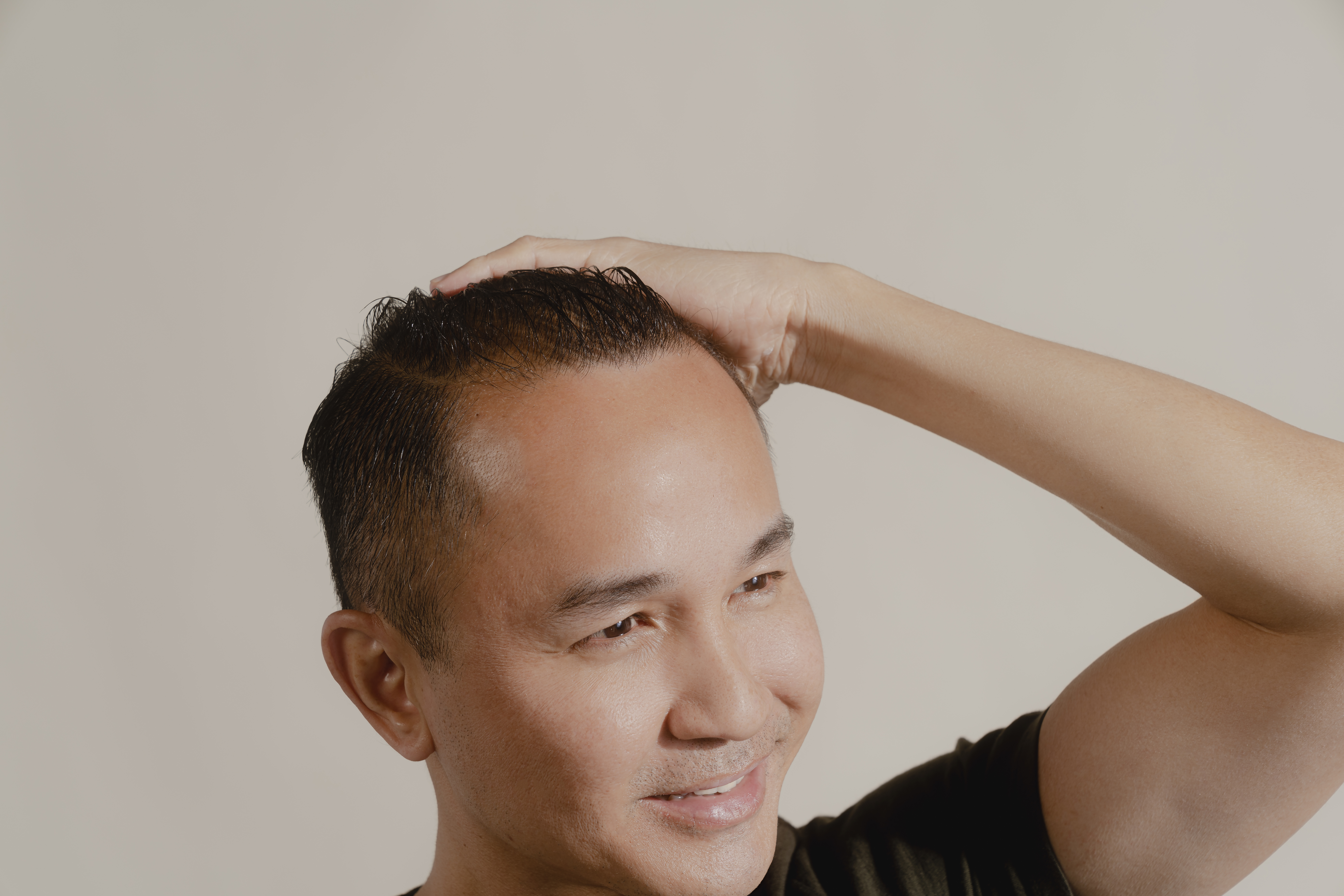 national hair loss awareness month