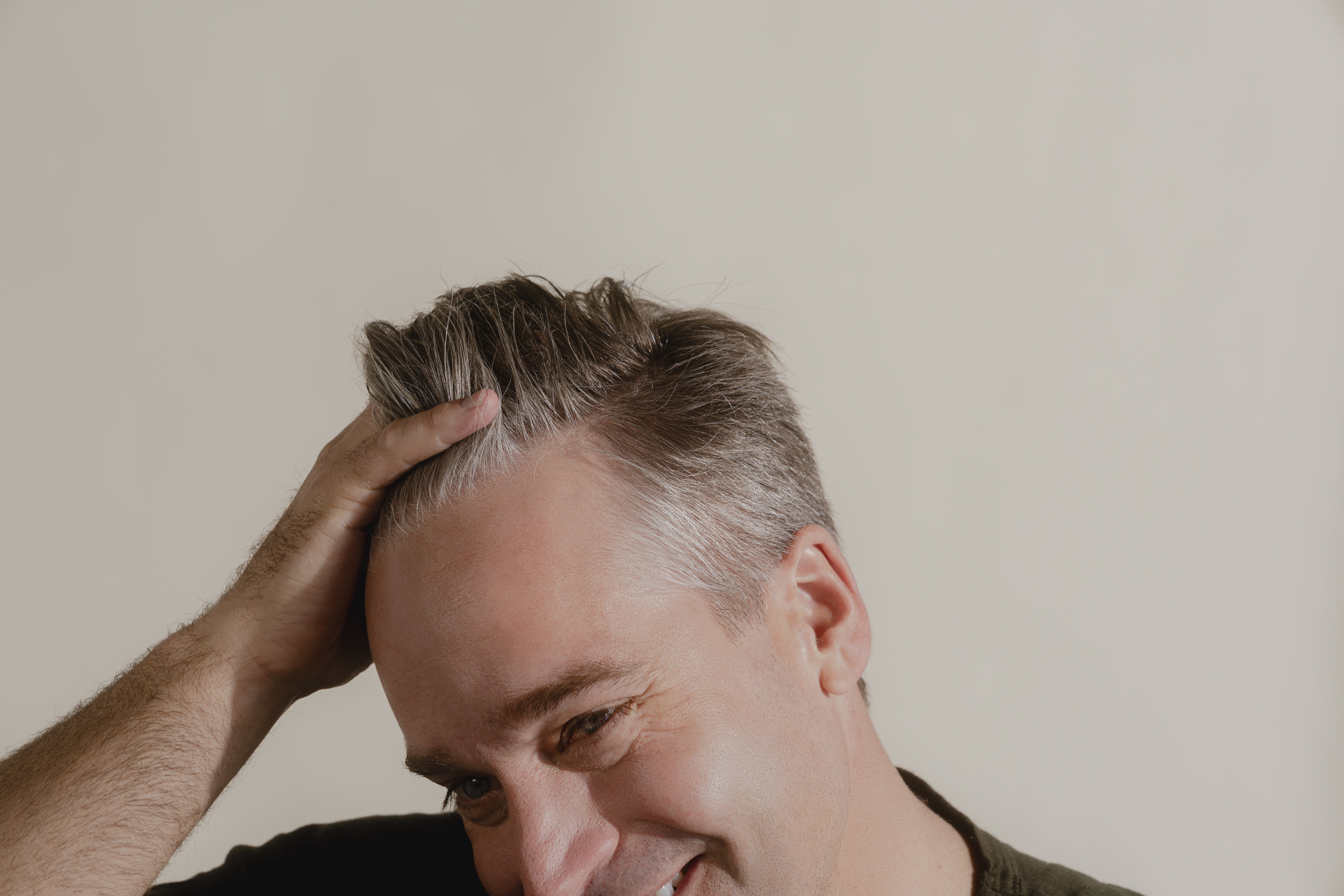 masturbation hair loss
